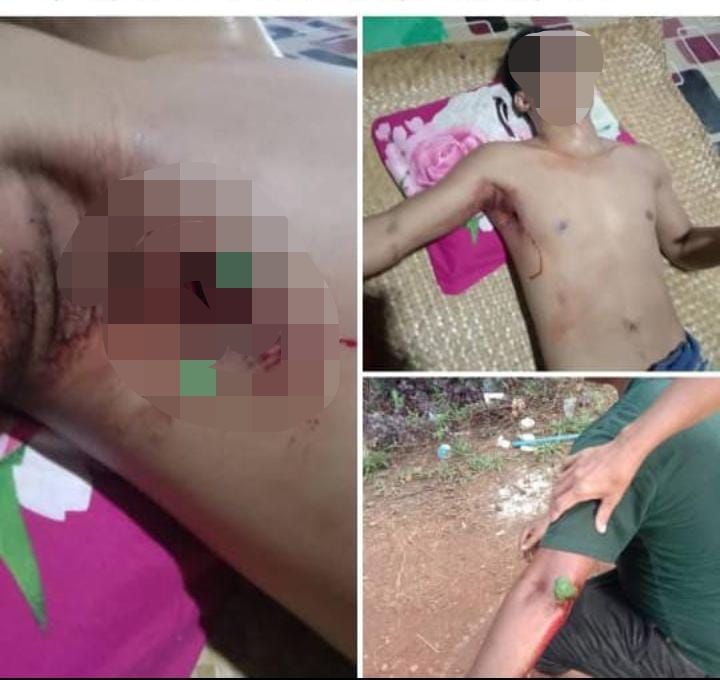 ADB Kalteng Kutuk Keras Aksi Penembakan Warga Kenyala di Areal Sawit PT Maju Aneka Sawit